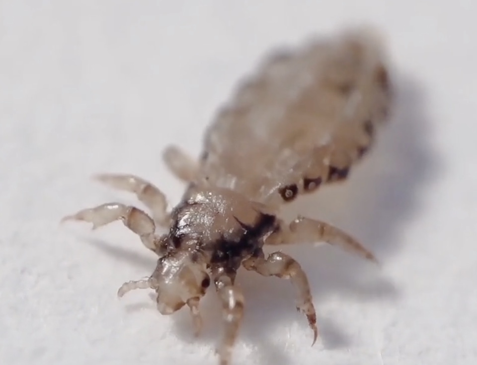 School Head Lice Outbreaks and Community Solutions